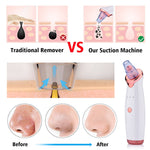 Load image into Gallery viewer, Beverlia Beauty Products | Blackhead remover Pore vacuum Blackhead remover machine Pore vacuum blackhead remover Pore cleaning Best pore vacuum 2020 Pore vacuum blackhead remover Blackhead remover vacuum Blackhead removal Nose blackhead remover tool Nose blackhead remover strips Nose blackhead remover machine
