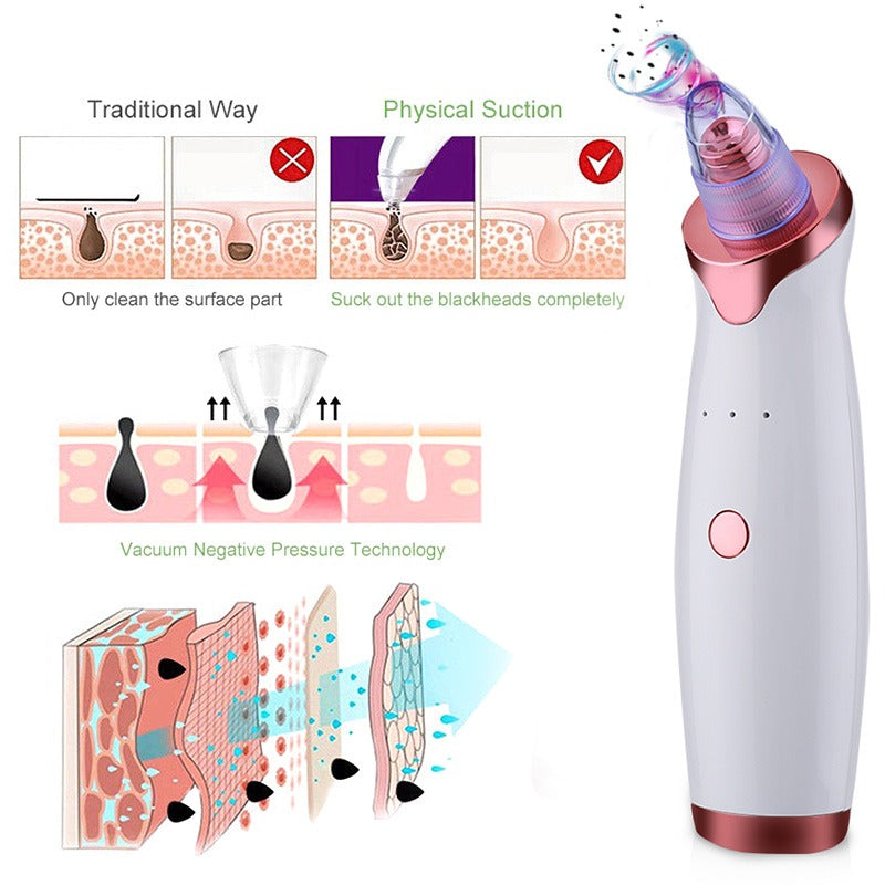 Beverlia Beauty Products | Blackhead remover Pore vacuum Blackhead remover machine Pore vacuum blackhead remover Pore cleaning Best pore vacuum 2020 Pore vacuum blackhead remover Blackhead remover vacuum Blackhead removal Nose blackhead remover tool Nose blackhead remover strips Nose blackhead remover machine