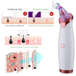 Load image into Gallery viewer, Beverlia Beauty Products | Blackhead remover Pore vacuum Blackhead remover machine Pore vacuum blackhead remover Pore cleaning Best pore vacuum 2020 Pore vacuum blackhead remover Blackhead remover vacuum Blackhead removal Nose blackhead remover tool Nose blackhead remover strips Nose blackhead remover machine
